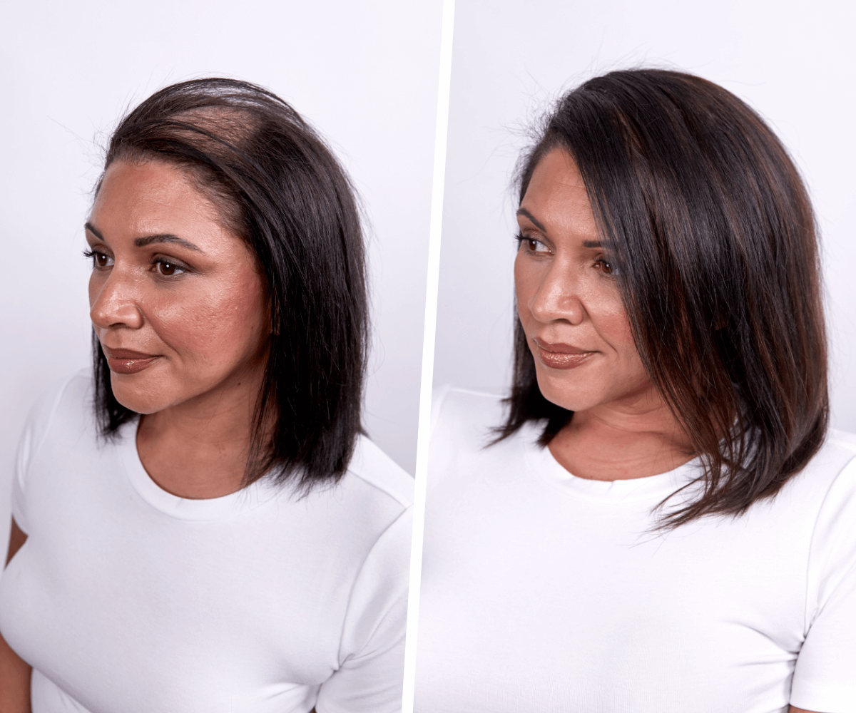 Real Stories of Hair Thinning and Hair Loss:  Extensions Designed for More than Just Length