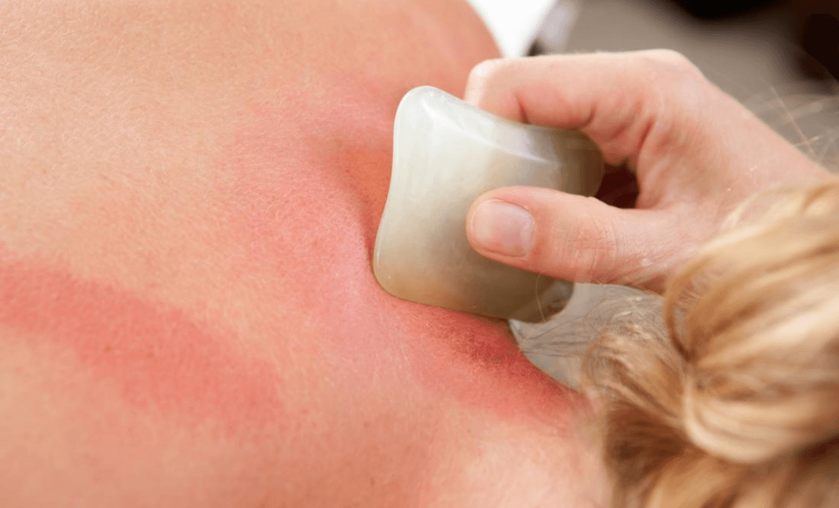 Gua Sha Muscle Scraping