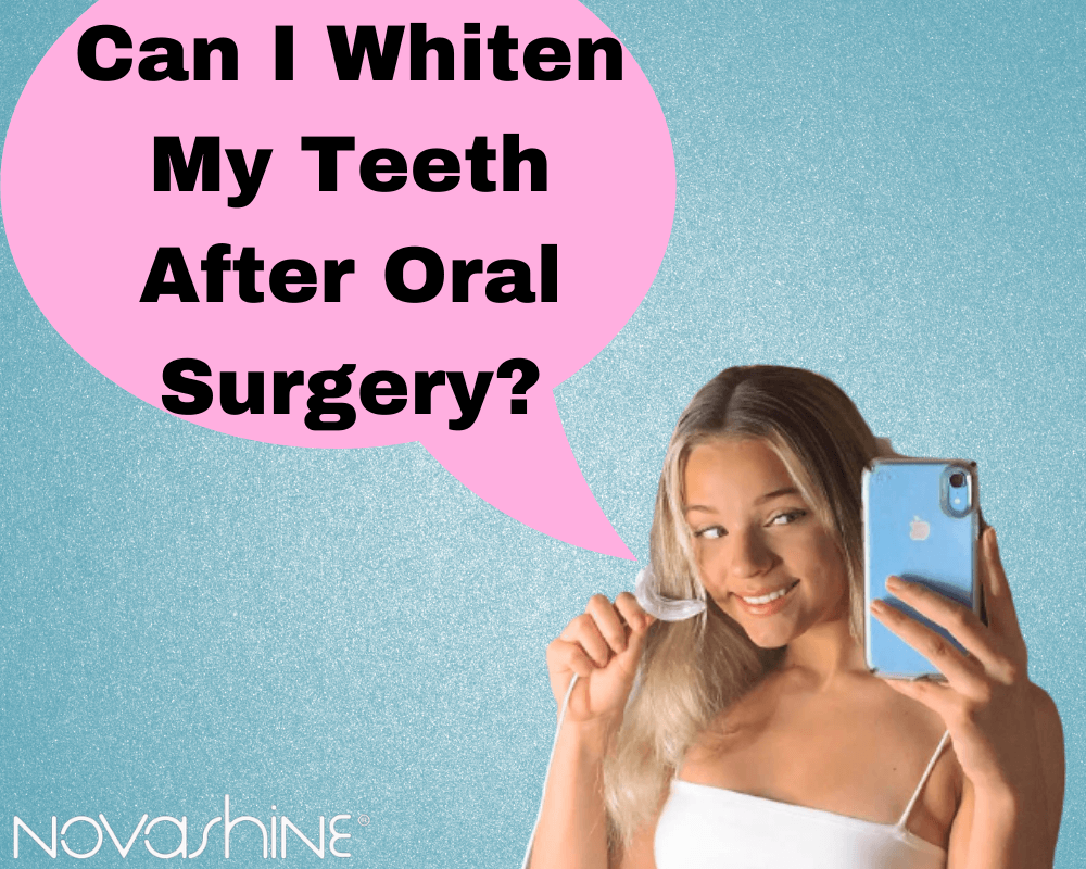 Can I Whiten My Teeth After Oral Surgery?