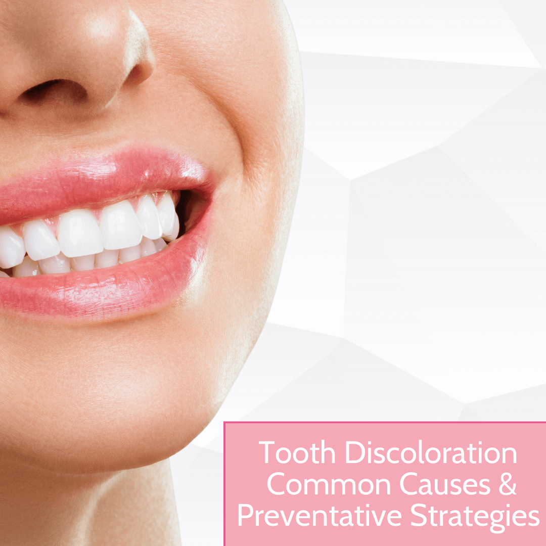 Tooth Discoloration Causes and Prevention