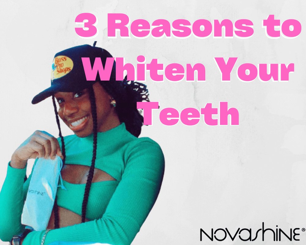 3 Reasons To Whiten Your Teeth