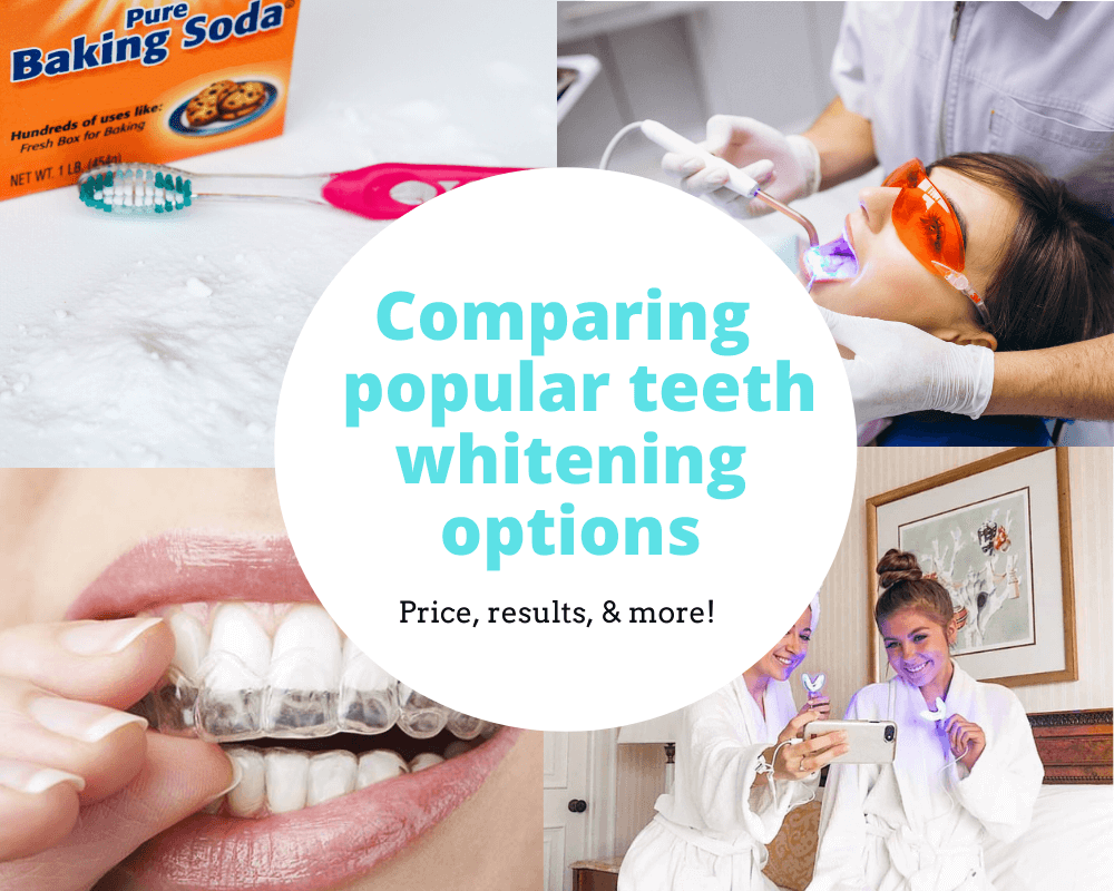 Most Popular Teeth Whitening Options Compared