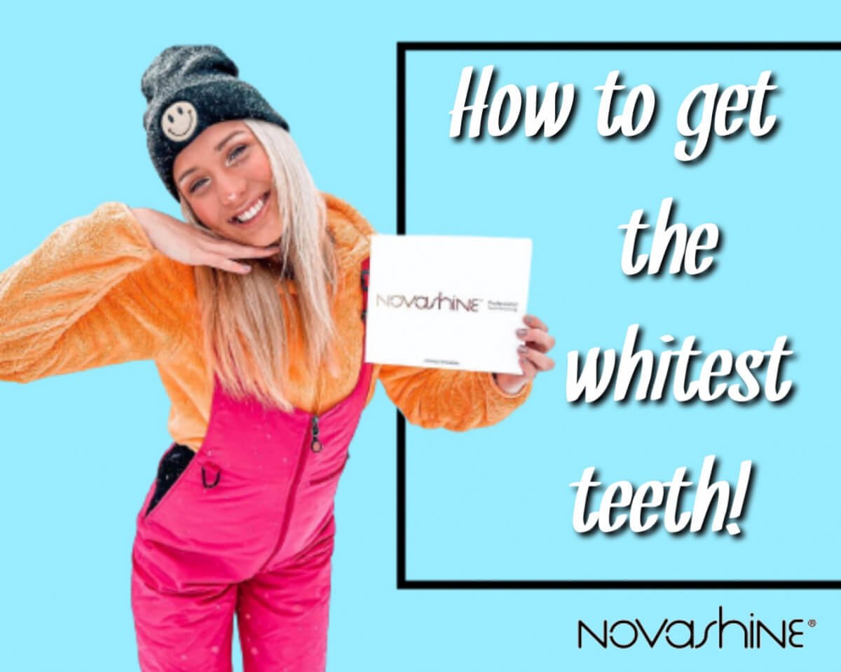 Tips For Getting the Whitest Teeth!