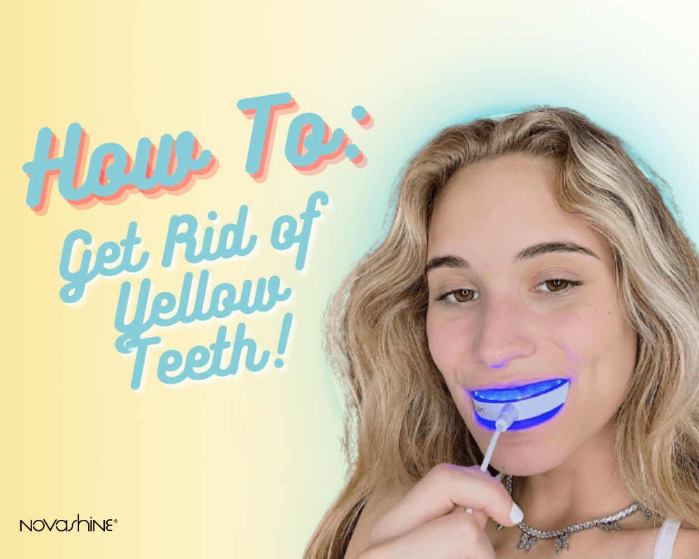 Teeth Whitening Kit - How To Get Rid Of Yellow Teeth