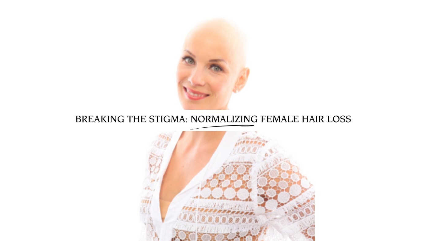 Female Hair Loss | Breaking The Stigma