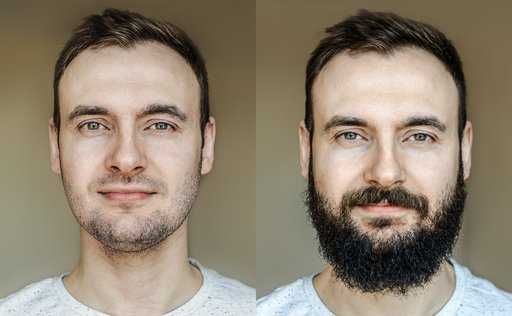 The Best Beard Shapes for Weak Jawline or Double Chin