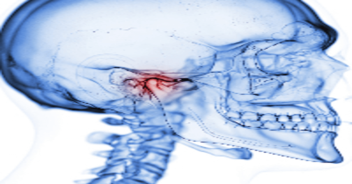 Treatment Options for  Temporomandibular Joint Disorders (TMD)