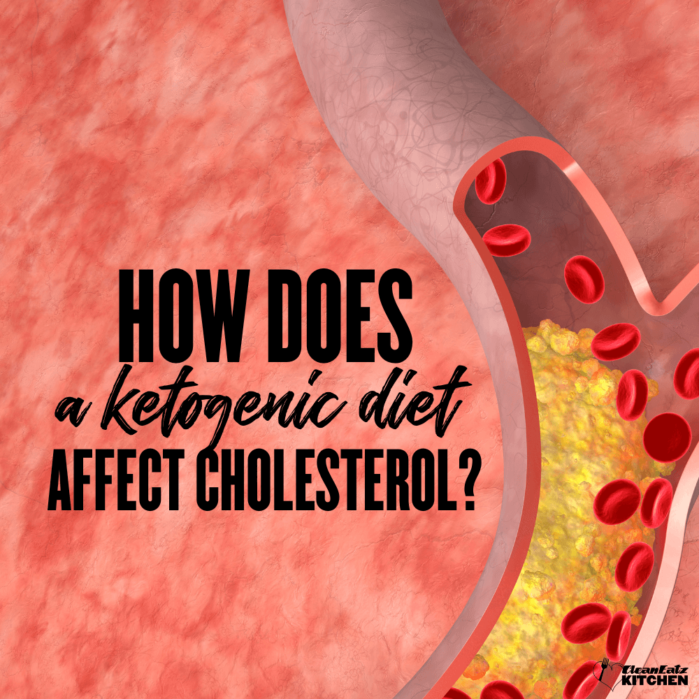 How Does Keto Diet Affect Cholesterol? Delving into the Impact of a Ketogenic Diet on Cholesterol Levels