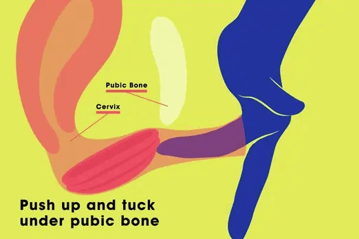 a diagram of how to to tuck a menstrual disc under a pubic bone