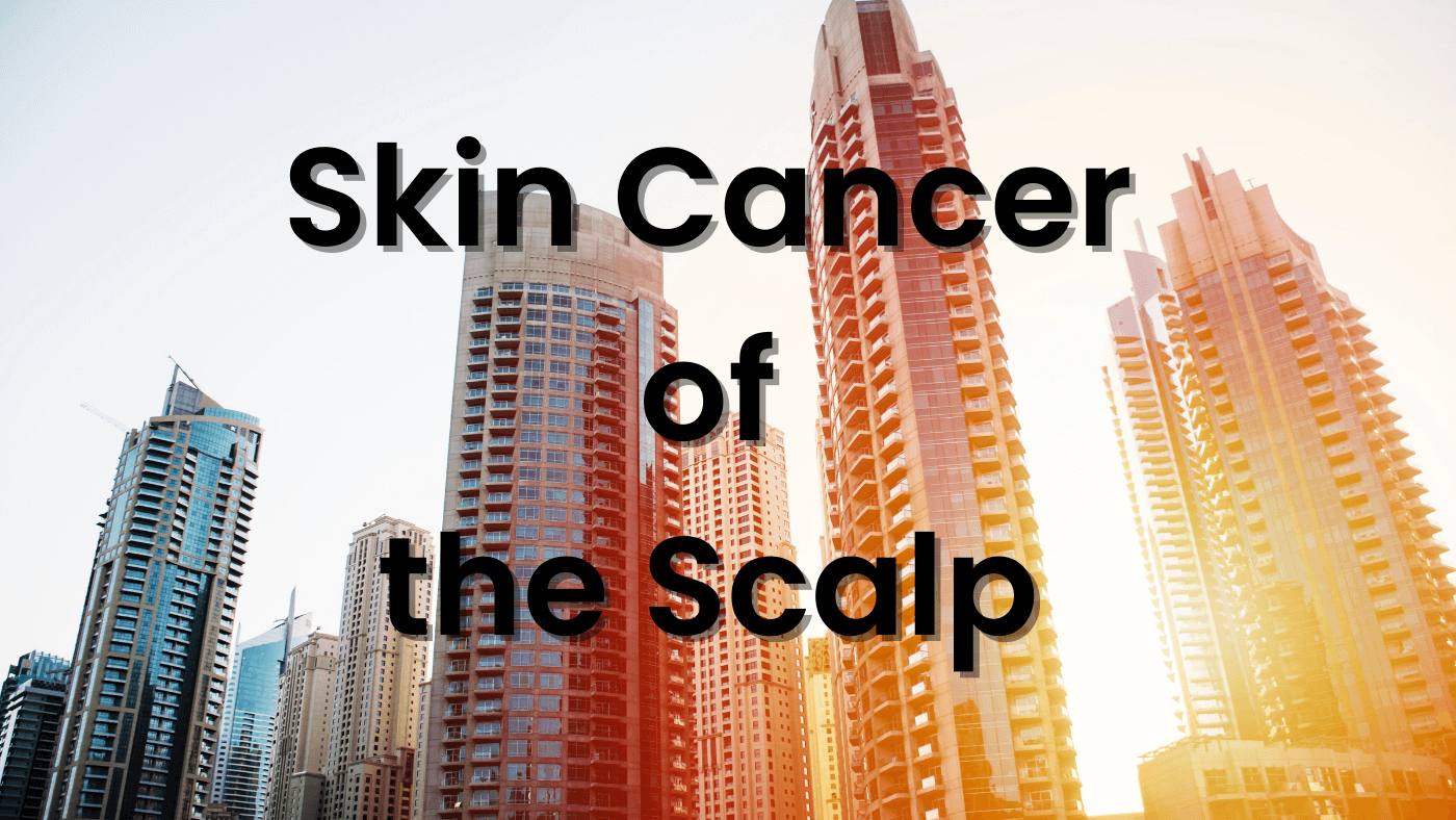 Skin Cancer of the Scalp: Causes & Importance of Prevention