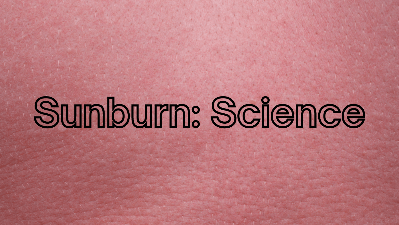 Sunburn Science