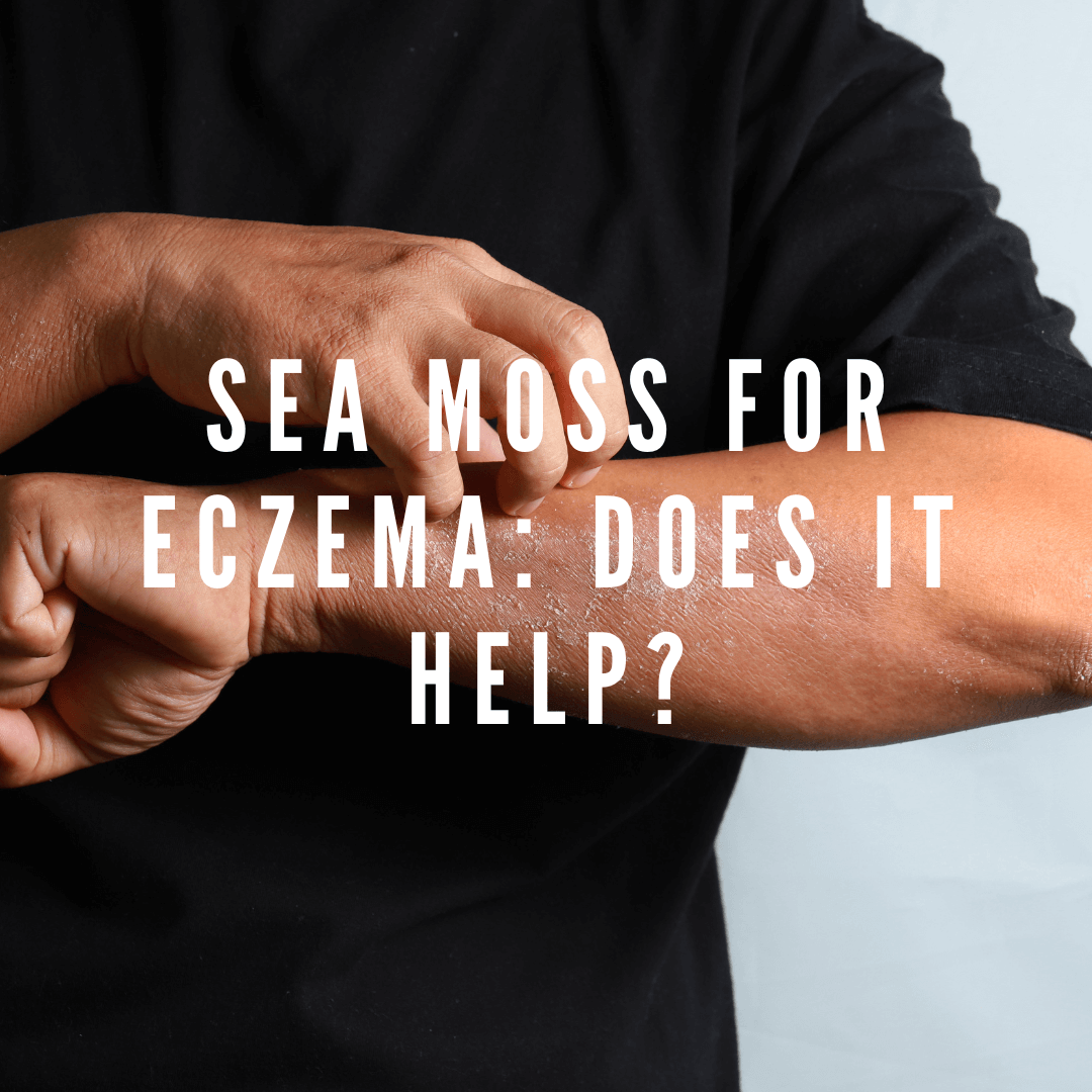 Sea Moss for Eczema: Does It Help?