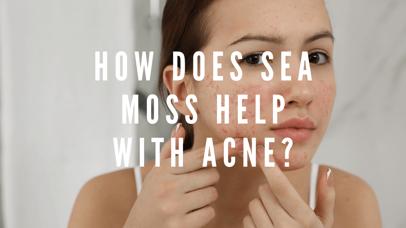 Sea Moss for Acne: How It Works and How to Use It