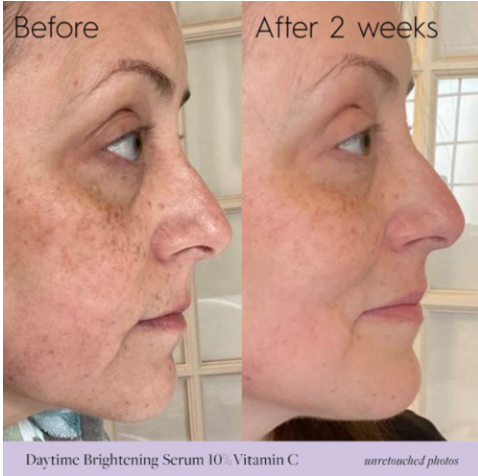The Power of Vitamin C in Skincare