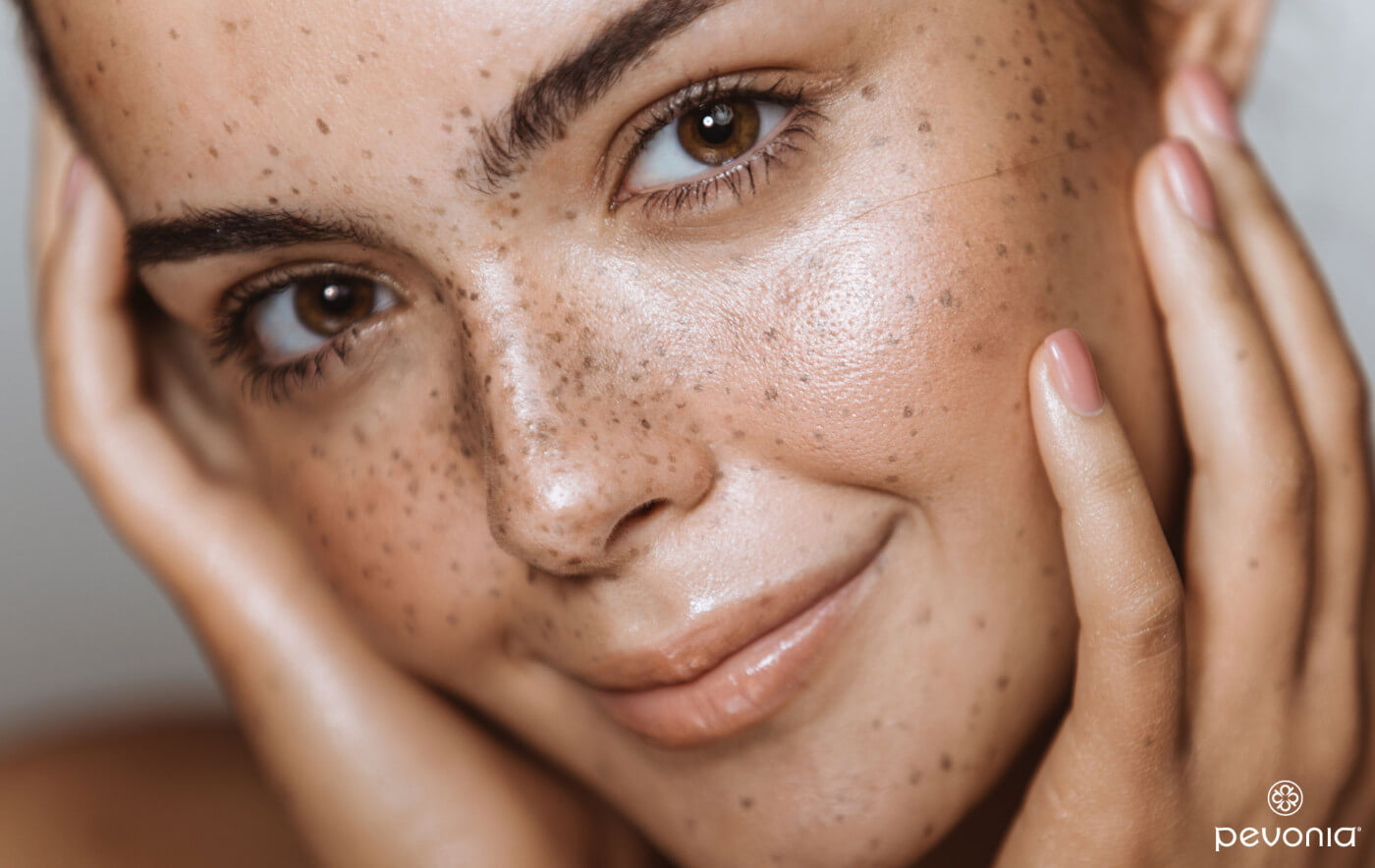 Blond Hair and Freckles: How to Embrace Your Features and Boost Your Confidence - wide 2