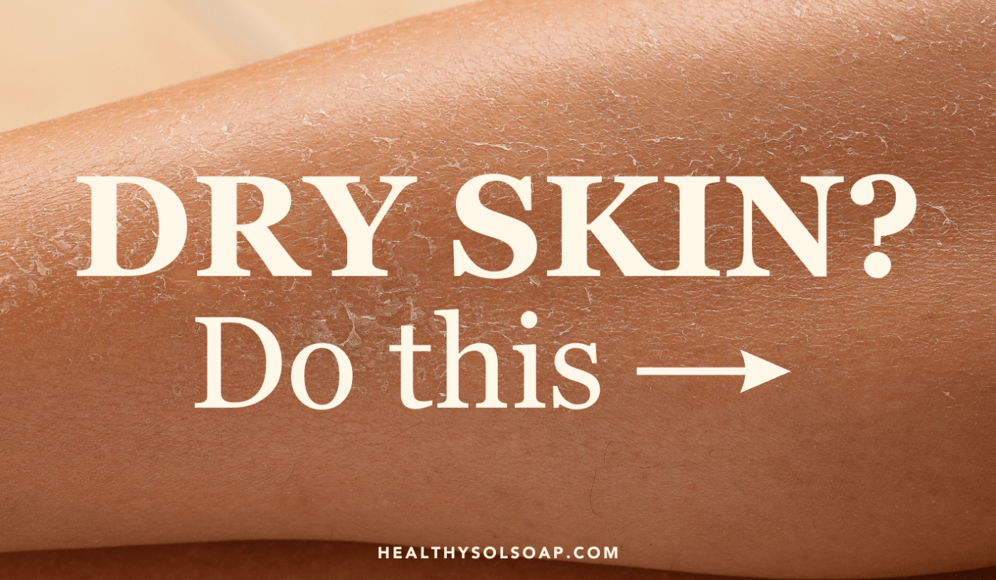 Suffering from Dry Skin? Do This