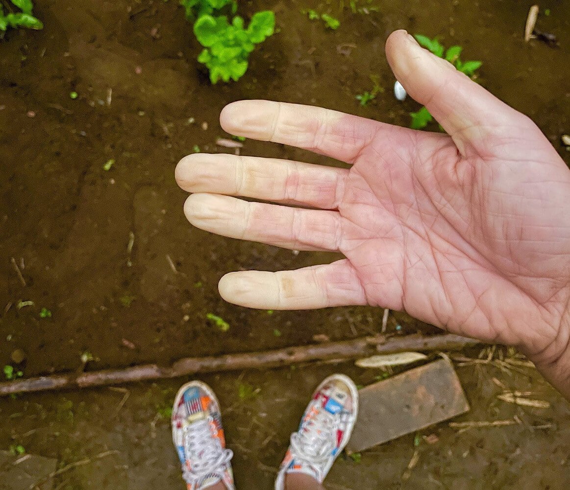 The Top 3 Things I Wish I'd Known When I Got Diagnosed with Raynaud's