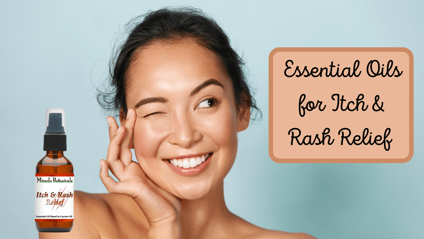 Essential Oil Recipe for Itchy Skin