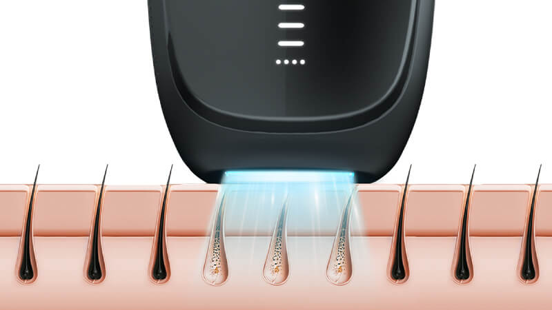 How IPL Works