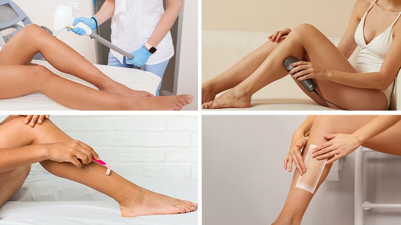 Laser hair removal IPL hair removal Shaving Hair removal cream Four types of hair removal