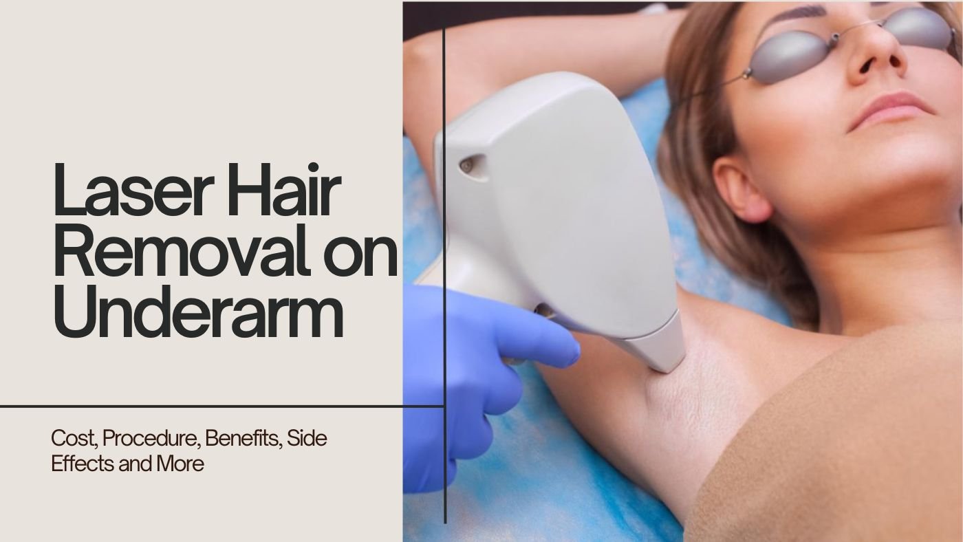 Laser Hair Removal on Underarm: Cost, Procedure, Benefits, Side Effects and More