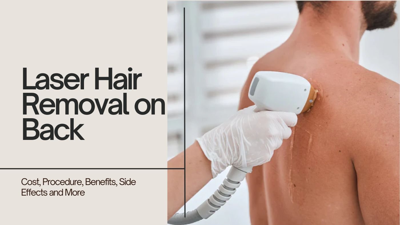 Laser Hair Removal on the Back: Cost, Procedure, Benefits, Side Effects and More