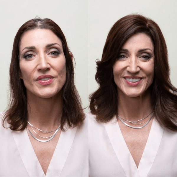 Side-by-side comparison of a woman before and after applying a hair topper—visible thinning on the left, fuller hair on the right.