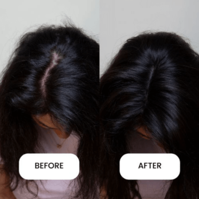 Hair Topper Before-After Top View Dimples Clio 14M  Remy Human Hair