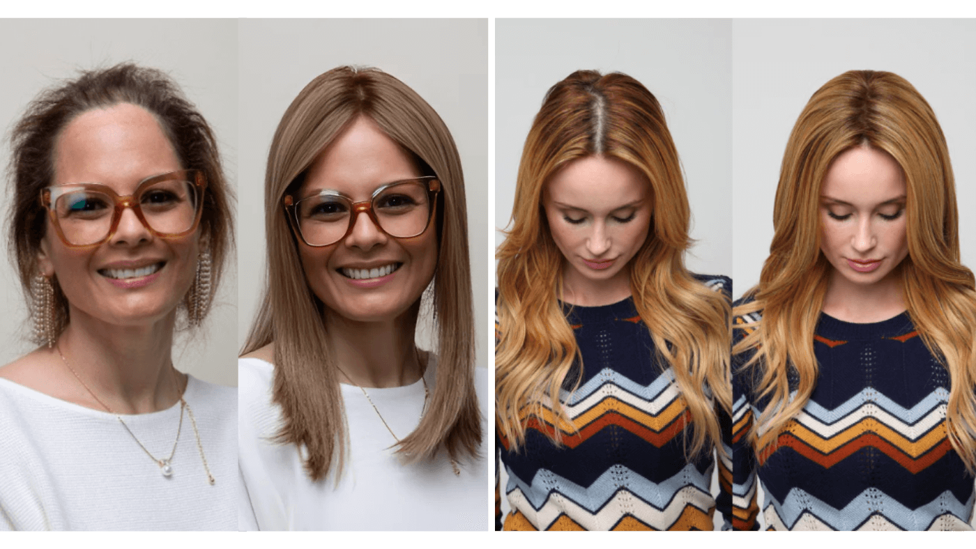 Image of two women; left displays thinning hair at the crown, right features thinning along the parting line.