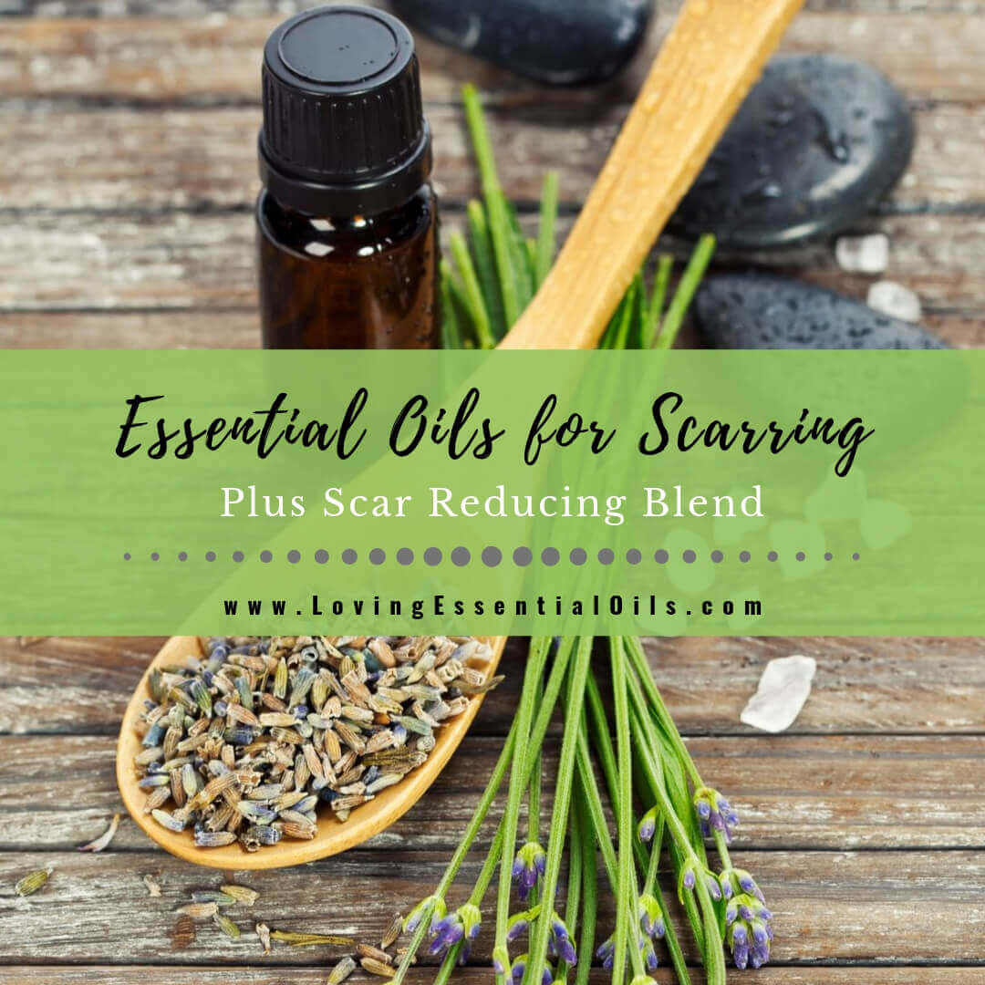 6 Best Essential Oils for Scarring with Scar Reducing Blend