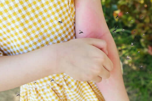 How to Treat a Mosquito Bite (And Enjoy the Outdoors Again)