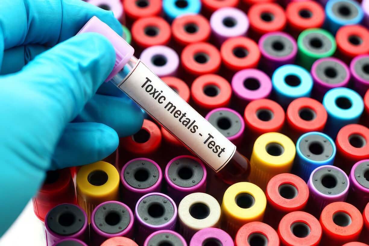 Heavy Metal Toxicity and Migraine: Risks & Signs