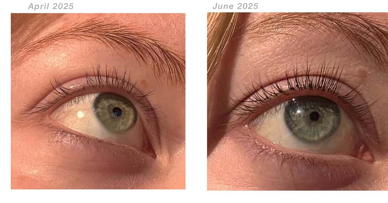 jena-before_after-plume_elite_jpg.png?v=1752321760