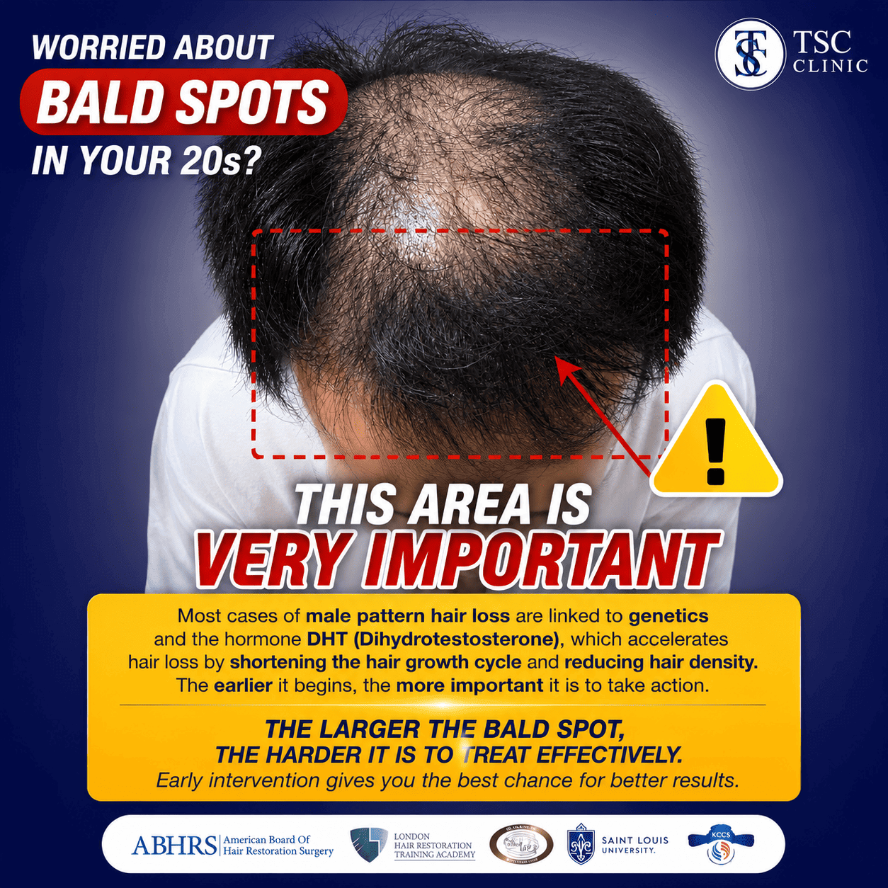  FRM Anti-Hair Loss Hair