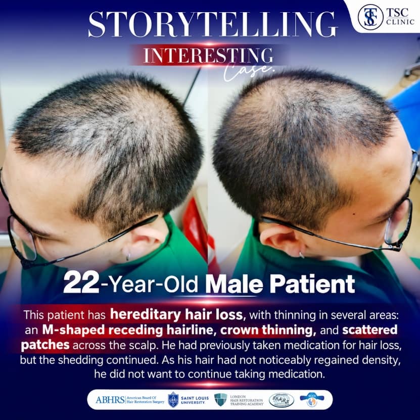 Interesting Storytelling: 22-year-old Male Patient