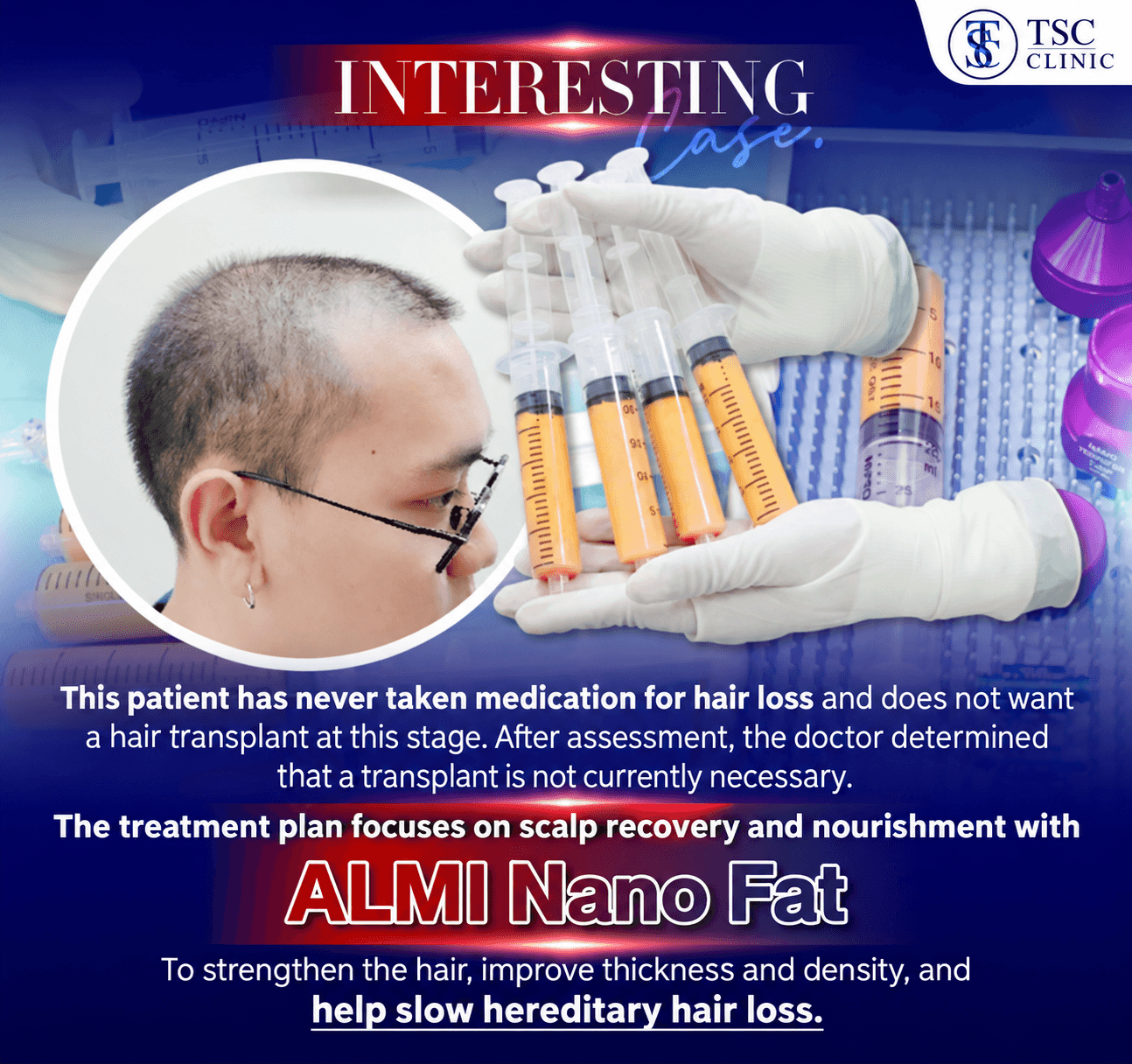 The treatment plan focuses on scalp recovery and nourishment with ALMI Nano Fat