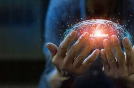 Alzheimer and 58 Resveratrol Trials