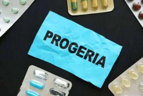 Does Resveratrol Have Any Chance Against Progeria?