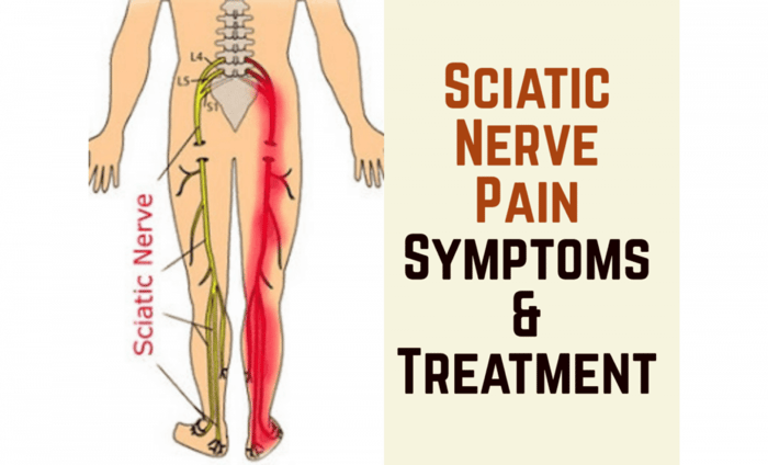 TENS Machine for Sciatica
