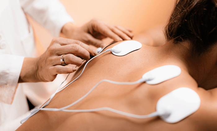 Does Electrical Stimulation Help Nerve Damage?