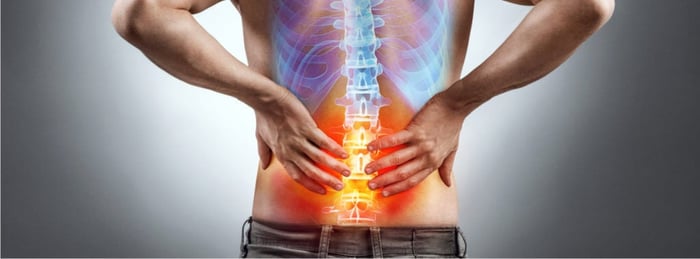 Are you Suffering from Sciatica? Or is it Piriformis Syndrome?