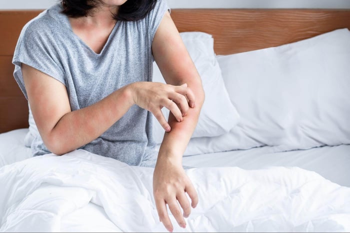 Woman that has itchy skin from allergies