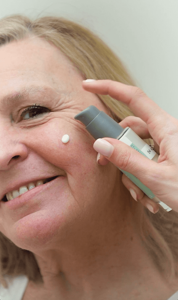 Couperose 🆘 wat je moet weten (en wat je eraan kan doen)