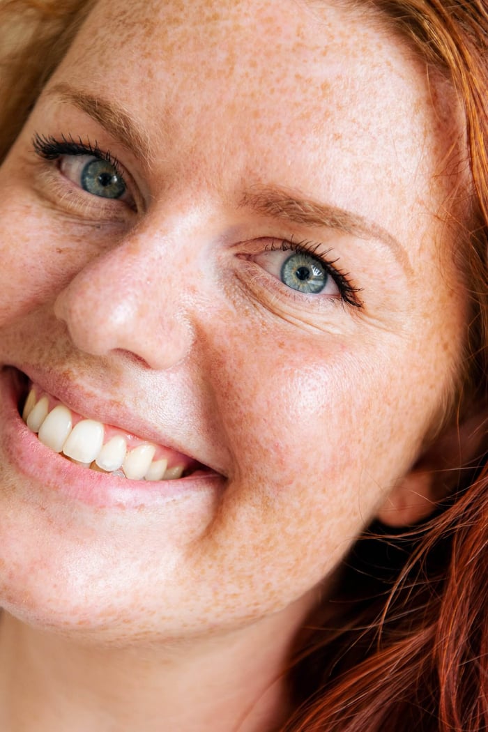 Van donkere kringen en wallen tot fijne lijntjes: zo krijg je een frisse, jeugdige oogopslag