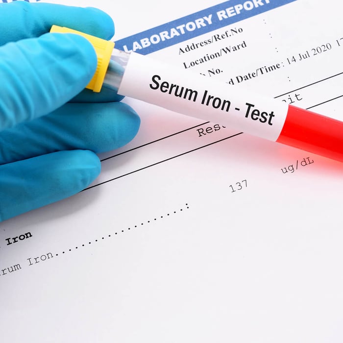 Iron Deficiency after Bariatric Surgery