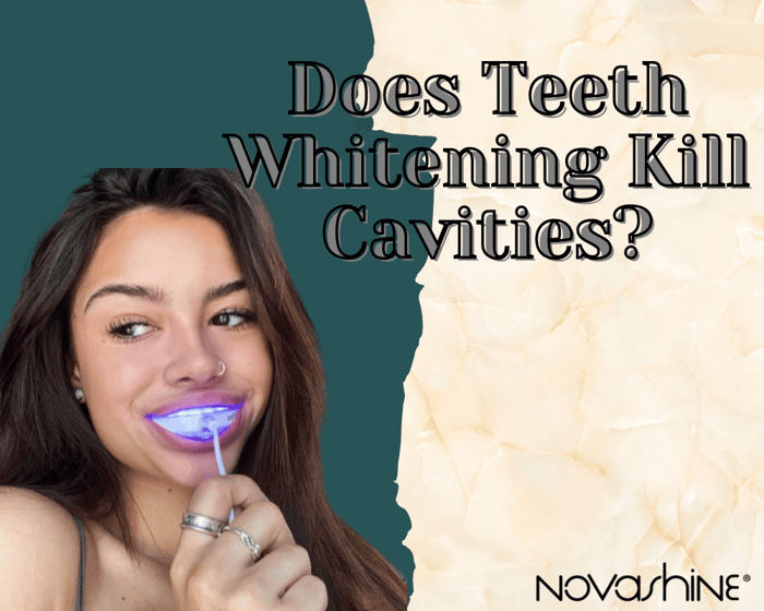 Does Teeth Whitening Kill Cavities?