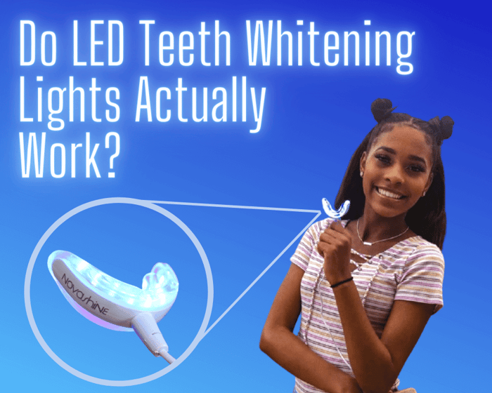 Do LED Teeth Whitening Lights Actually Work?