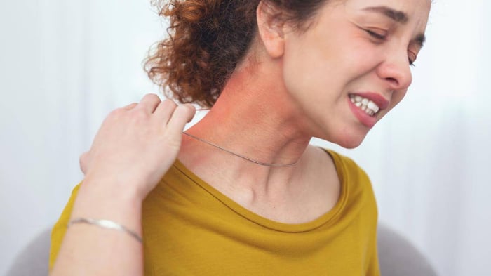 Jewellery Allergies And How To Avoid Them