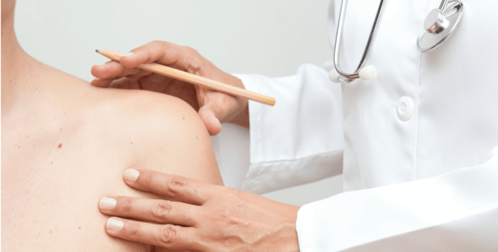 The Most Common Skin Cancer Myths