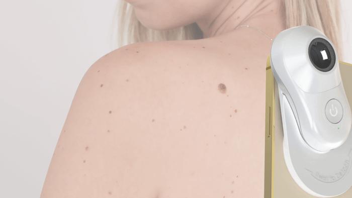 The Ultimate Guide to Skin Checks